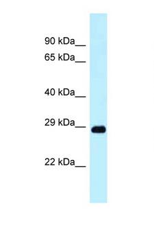 DRAM1 / DRAM Antibody - DRAM1 / DRAM antibody Western blot of Small Intestine lysate. Antibody concentration 1 ug/ml.  This image was taken for the unconjugated form of this product. Other forms have not been tested.