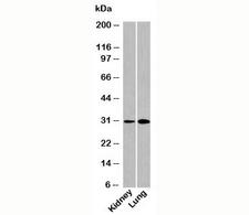 DRAM1 / DRAM Antibody - DRAM antibody western blot of human samples