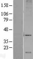 DRAM1 / DRAM Protein - Western validation with an anti-DDK antibody * L: Control HEK293 lysate R: Over-expression lysate