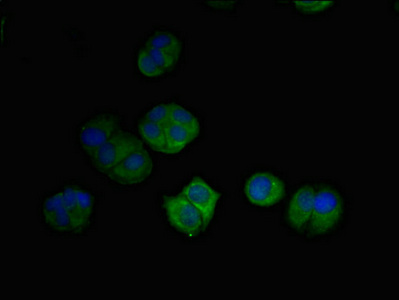 DRAM2 Antibody - Immunofluorescent analysis of mcf-7 cells diluted at 1:100 and Alexa Fluor 488-congugated AffiniPure Goat Anti-Rabbit IgG(H+L)