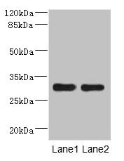 DRAM2 Antibody - Western blot All Lanes: DRAM2 antibody at 3.84ug/ml Lane 1: Mouse heart tissue Lane 2: Mouse liver tissue Secondary Goat polyclonal to Rabbit IgG at 1/10000 dilution Predicted band size: 30 kDa Observed band size: 30 kDa