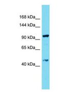 DRC7 / CCDC135 Antibody - Western blot of CCDC135 Antibody - C-terminal region with human THP-1 cells lysate.  This image was taken for the unconjugated form of this product. Other forms have not been tested.