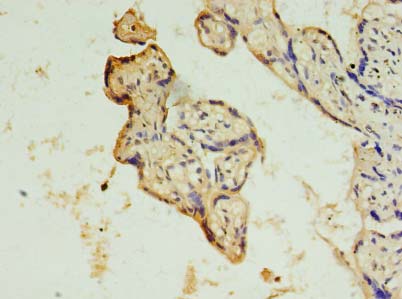 DRC7 / CCDC135 Antibody - Immunohistochemistry of paraffin-embedded human placenta tissue using antibody at dilution of 1:100.