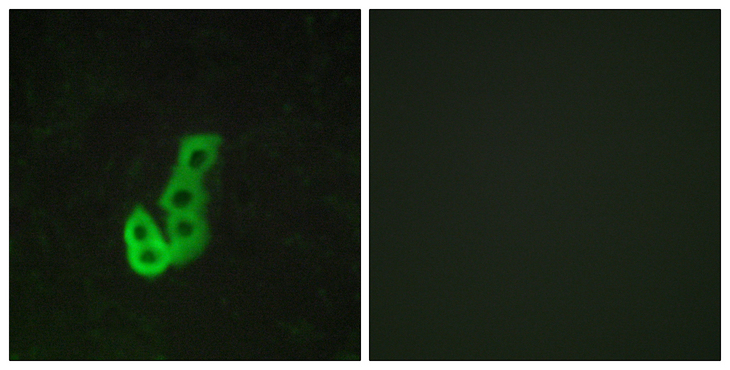 DRD1 / Dopamine Receptor D1 Antibody - Immunofluorescence analysis of MCF7 cells, using DRD1 Antibody. The picture on the right is blocked with the synthesized peptide.