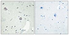 DRD1 / Dopamine Receptor D1 Antibody - Immunohistochemistry analysis of paraffin-embedded human brain tissue, using DRD1 Antibody. The picture on the right is blocked with the synthesized peptide.