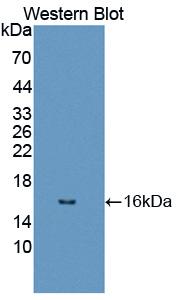 DRD1 / Dopamine Receptor D1 Antibody - Western blot of DRD1 / Dopamine Receptor D1 antibody.