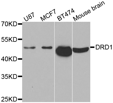DRD1 / Dopamine Receptor D1 Antibody - Western blot analysis of extracts of various cell lines.