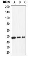 DRD1 / Dopamine Receptor D1 Antibody - Western blot analysis of Dopamine Receptor D1 expression in HeLa (A); NIH3T3 (B); H9C2 (C) whole cell lysates.