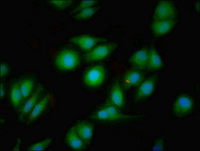 DRD1 / Dopamine Receptor D1 Antibody - Immunofluorescent analysis of A549 cells using DRD1 Antibody at dilution of 1:100 and Alexa Fluor 488-congugated AffiniPure Goat Anti-Rabbit IgG(H+L)