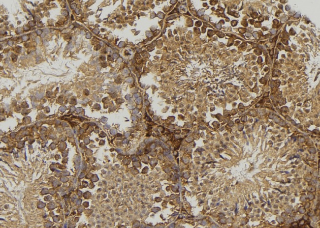 DRD1 / Dopamine Receptor D1 Antibody - 1:100 staining mouse testis tissue by IHC-P. The sample was formaldehyde fixed and a heat mediated antigen retrieval step in citrate buffer was performed. The sample was then blocked and incubated with the antibody for 1.5 hours at 22°C. An HRP conjugated goat anti-rabbit antibody was used as the secondary.