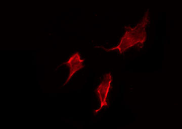 DRD1 / Dopamine Receptor D1 Antibody - Staining HepG2 cells by IF/ICC. The samples were fixed with PFA and permeabilized in 0.1% Triton X-100, then blocked in 10% serum for 45 min at 25°C. The primary antibody was diluted at 1:200 and incubated with the sample for 1 hour at 37°C. An Alexa Fluor 594 conjugated goat anti-rabbit IgG (H+L) Ab, diluted at 1/600, was used as the secondary antibody.