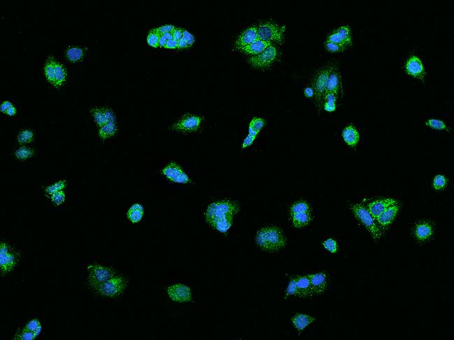 DRD1 / Dopamine Receptor D1 Antibody - Immunofluorescence staining of DRD1 in MCF7 cells. Cells were fixed with 4% PFA, permeabilzed with 0.1% Triton X-100 in PBS, blocked with 10% serum, and incubated with rabbit anti-Human DRD1 polyclonal antibody (dilution ratio 1:100) at 4°C overnight. Then cells were stained with the Alexa Fluor 488-conjugated Goat Anti-rabbit IgG secondary antibody (green) and counterstained with DAPI (blue). Positive staining was localized to Cytoplasm.