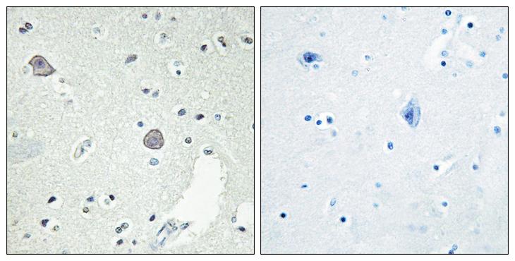 DRD1 / Dopamine Receptor D1 Antibody - Peptide - + Immunohistochemistry analysis of paraffin-embedded human brain tissue, using DRD1 antibody.