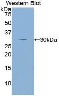 DRD2 / Dopamine Receptor D2 Antibody - Western blot of recombinant DRD2 / Dopamine Receptor D2.