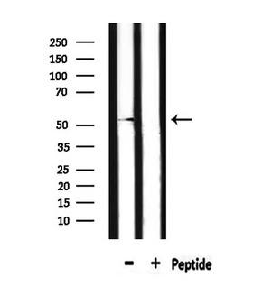 DRD2 / Dopamine Receptor D2 Antibody - Western blot analysis of extracts of HepG2 cells using DRD2 antibody.