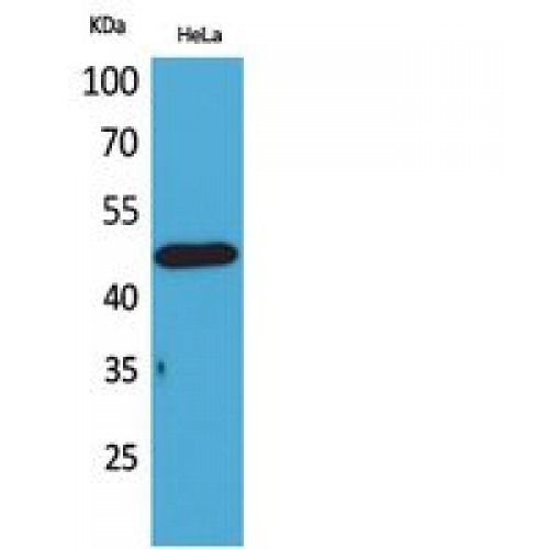 DRD3 / Dopamine Receptor D3 Antibody - Western blot of D3DR antibody