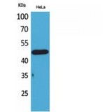 DRD3 / Dopamine Receptor D3 Antibody - Western blot of D3DR antibody