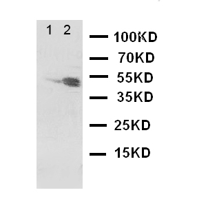 DRD3 / Dopamine Receptor D3 Antibody - WB of DRD3 / Dopamine Receptor D3 antibody. Lane 1: Rat Testis Tissue Lysate. Lane 2: Rat Brain Tissue Lysate.
