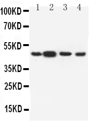 DRD3 / Dopamine Receptor D3 Antibody - Anti-Dopamine Receptor D3 antibody, Western blotting Lane 1: Rat Testis Tissue LysateLane 2: Rat Brain Tissue LysateLane 3: U87 Cell LysateLane 4: HELA Cell Lysate