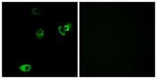 DRD4 / Dopamine Receptor D4 Antibody - Immunofluorescence analysis of MCF7 cells, using DRD4 Antibody. The picture on the right is blocked with the synthesized peptide.