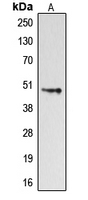 DRD4 / Dopamine Receptor D4 Antibody - Western blot analysis of Dopamine Receptor D4 expression in HeLa (A) whole cell lysates.