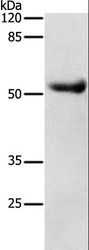 DRD4 / Dopamine Receptor D4 Antibody - Western blot analysis of Human liver cancer tissue, using DRD4 Polyclonal Antibody at dilution of 1:600.