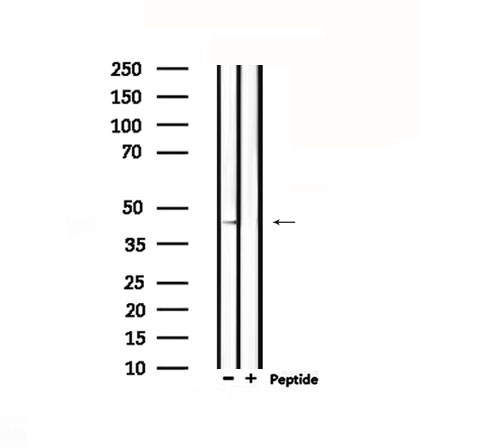 DRD4 / Dopamine Receptor D4 Antibody - Western blot analysis of extracts of rat muscle using DRD4 antibody.