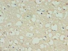 DRD5 / Dopamine Receptor D5 Antibody - Immunohistochemistry of paraffin-embedded human brain tissue using antibody at 1:100 dilution.  This image was taken for the unconjugated form of this product. Other forms have not been tested.