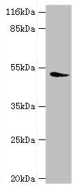 DRD5 / Dopamine Receptor D5 Antibody - Western blot All lanes: DRD5 antibody at 2µg/ml + Mouse brain tissue Secondary Goat polyclonal to rabbit IgG at 1/10000 dilution Predicted band size: 53 kDa Observed band size: 53 kDa