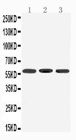 DRD5 / Dopamine Receptor D5 Antibody - WB of DRD5 / Dopamine Receptor D5 antibody. Lane 1: Rat Brain Tissue Lysate. Lane 2: Mouse Brain Tissue Lysate. Lane 3: U87 Cell Lysate.