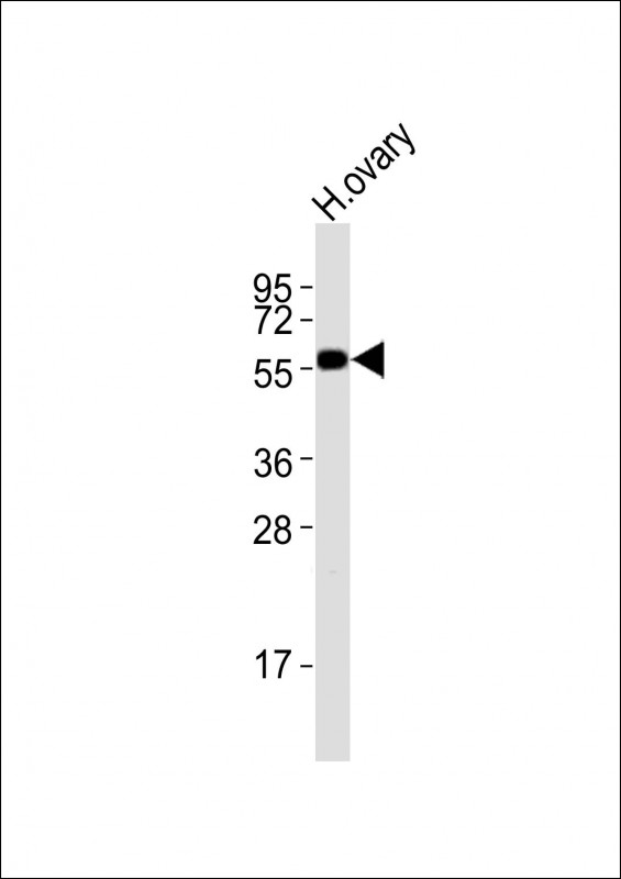 DRD5 / Dopamine Receptor D5 Antibody - Anti-DRD5 Antibody at 1:2000 dilution + human ovary lysates Lysates/proteins at 20 ug per lane. Secondary Goat Anti-Rabbit IgG, (H+L), Peroxidase conjugated at 1/10000 dilution Predicted band size : 53 kDa Blocking/Dilution buffer: 5% NFDM/TBST.