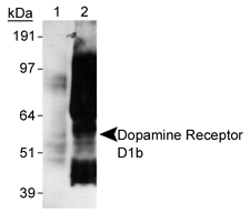DRD5 / Dopamine Receptor D5 Antibody - Detection of Dopamine Receptor D1a of Sf9 cells transfected with rat D1b. Lane 1: Sf9-D1b lysate Lane 2: Sf9-D1a lysate.  This image was taken for the unconjugated form of this product. Other forms have not been tested.