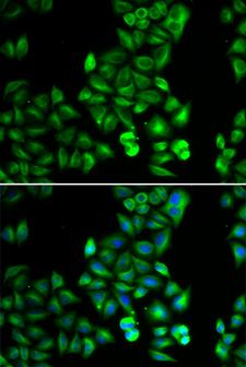 DRD5 / Dopamine Receptor D5 Antibody - Immunofluorescence analysis of HeLa cells.