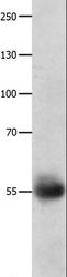 DRD5 / Dopamine Receptor D5 Antibody - Western blot analysis of Human ovarian cancer tissue, using DRD5 Polyclonal Antibody at dilution of 1:800.