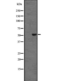 DRD5 / Dopamine Receptor D5 Antibody - Western blot analysis of DRD5 expression in HEK293 cells. The lane on the left is treated with the antigen-specific peptide.