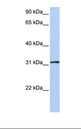 DRG1 / NEDD3 Antibody - 721_B cell lysate. Antibody concentration: 1.0 ug/ml. Gel concentration: 12%.  This image was taken for the unconjugated form of this product. Other forms have not been tested.