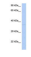DRG1 / NEDD3 Antibody - DRG1 antibody Western blot of Fetal Spleen lysate. This image was taken for the unconjugated form of this product. Other forms have not been tested.