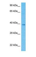 DRG1 / NEDD3 Antibody - Western blot of DRG1 Antibody with human OVCAR-3 Whole Cell lysate.  This image was taken for the unconjugated form of this product. Other forms have not been tested.