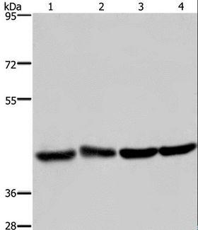 DRG1 / NEDD3 Antibody - Western blot analysis of Human fetal liver and brain tissue, 293T and HeLa cell, using DRG1 Polyclonal Antibody at dilution of 1:350.