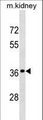 DRG2 Antibody - DRG2 Antibody western blot of mouse kidney tissue lysates (35 ug/lane). The DRG2 antibody detected the DRG2 protein (arrow).