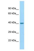 DRG2 Antibody - DRG2 antibody Western Blot of Fetal Kidney. Antibody dilution: 1 ug/ml.  This image was taken for the unconjugated form of this product. Other forms have not been tested.