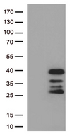 DRGX Antibody - HEK293T cells were transfected with the pCMV6-ENTRY control. (Left lane) or pCMV6-ENTRY DRGX. (Right lane) cDNA for 48 hrs and lysed. Equivalent amounts of cell lysates. (5 ug per lane) were separated by SDS-PAGE and immunoblotted with anti-DRGX. (1:500)
