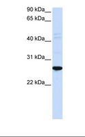 DRGX Antibody - Hela cell lysate. Antibody concentration: 1.0 ug/ml. Gel concentration: 12%.  This image was taken for the unconjugated form of this product. Other forms have not been tested.