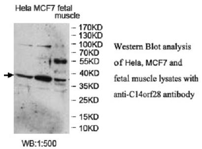 DRIP1 / C14orf28 Antibody - Western blot of DRIP1 / C14orf28 antibody