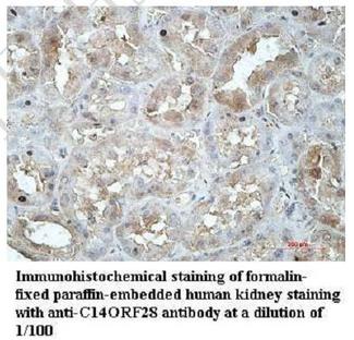 DRIP1 / C14orf28 Antibody - Immunohistochemistry of DRIP1 / C14orf28 antibody