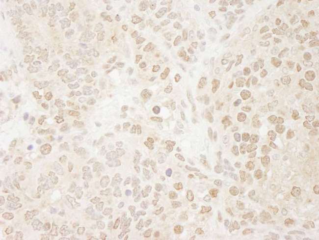 DROSHA / RNASEN Antibody - Detection of Mouse Drosha by Immunohistochemistry. Sample: FFPE section of mouse teratoma. Antibody: Affinity purified rabbit anti-Drosha used at a dilution of 1:250. Epitope Retrieval Buffer-High pH (IHC-101J) was substituted for Epitope Retrieval Buffer-Reduced pH.