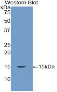 DROSHA / RNASEN Antibody - Western blot of recombinant DROSHA.  This image was taken for the unconjugated form of this product. Other forms have not been tested.