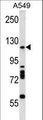 DROSHA / RNASEN Antibody - Mouse RNASEN Antibody western blot of A549 cell line lysates (35 ug/lane). The RNASEN antibody detected the RNASEN protein (arrow).