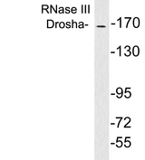 DROSHA / RNASEN Antibody - Western blot analysis of lysates from brain tissue, using RNase III Drosha antibody.