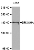 DROSHA / RNASEN Antibody - Western blot analysis of extracts of K562 cells.